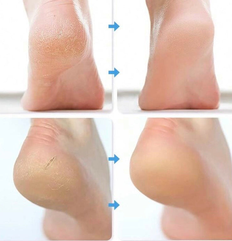 Hydrating Silicone Spa Socks- גרבי ספא סיליקון לחות